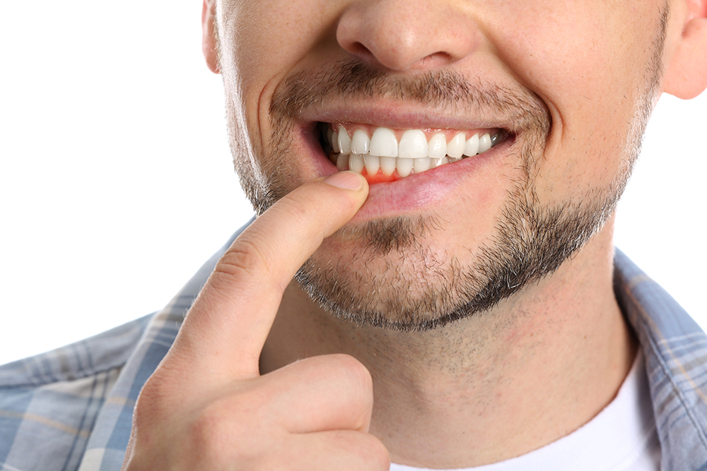What Is Periodontal Therapy and How Does It Help?