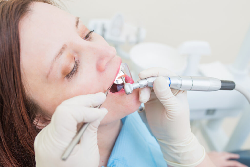 Middle aged woman patient at the dentist polishing the tooth with a disc and making dental fillings